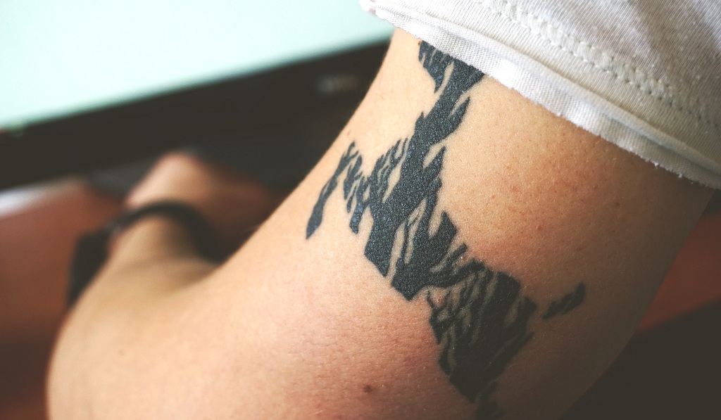 Ingrown Hair on a Tattoo