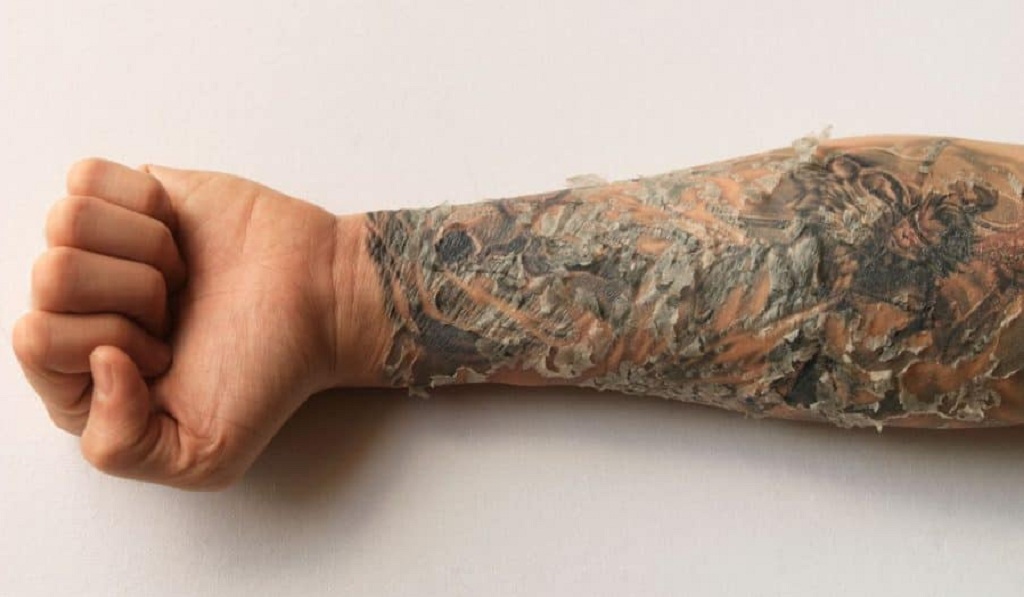 Why Is My Tattoo Peeling