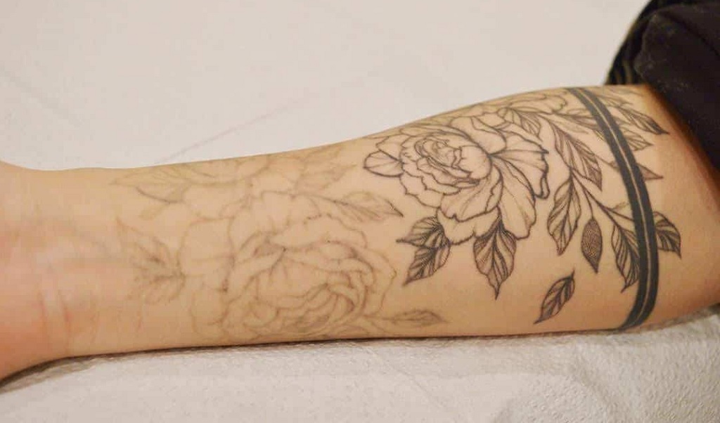 How to Fade a Tattoo