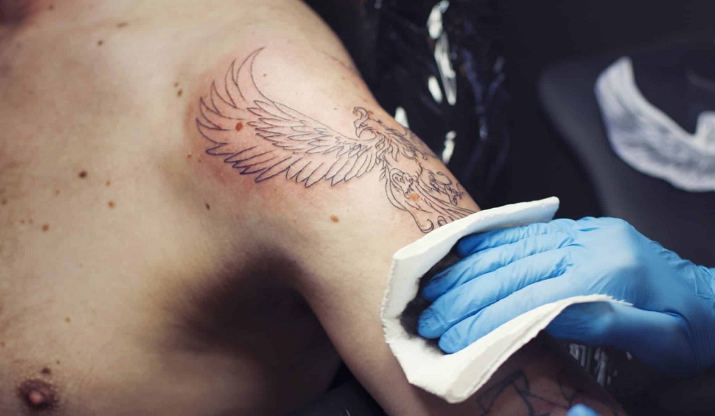 Why Is My Tattoo Raised